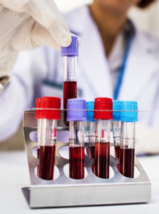 биохимический анализ крови